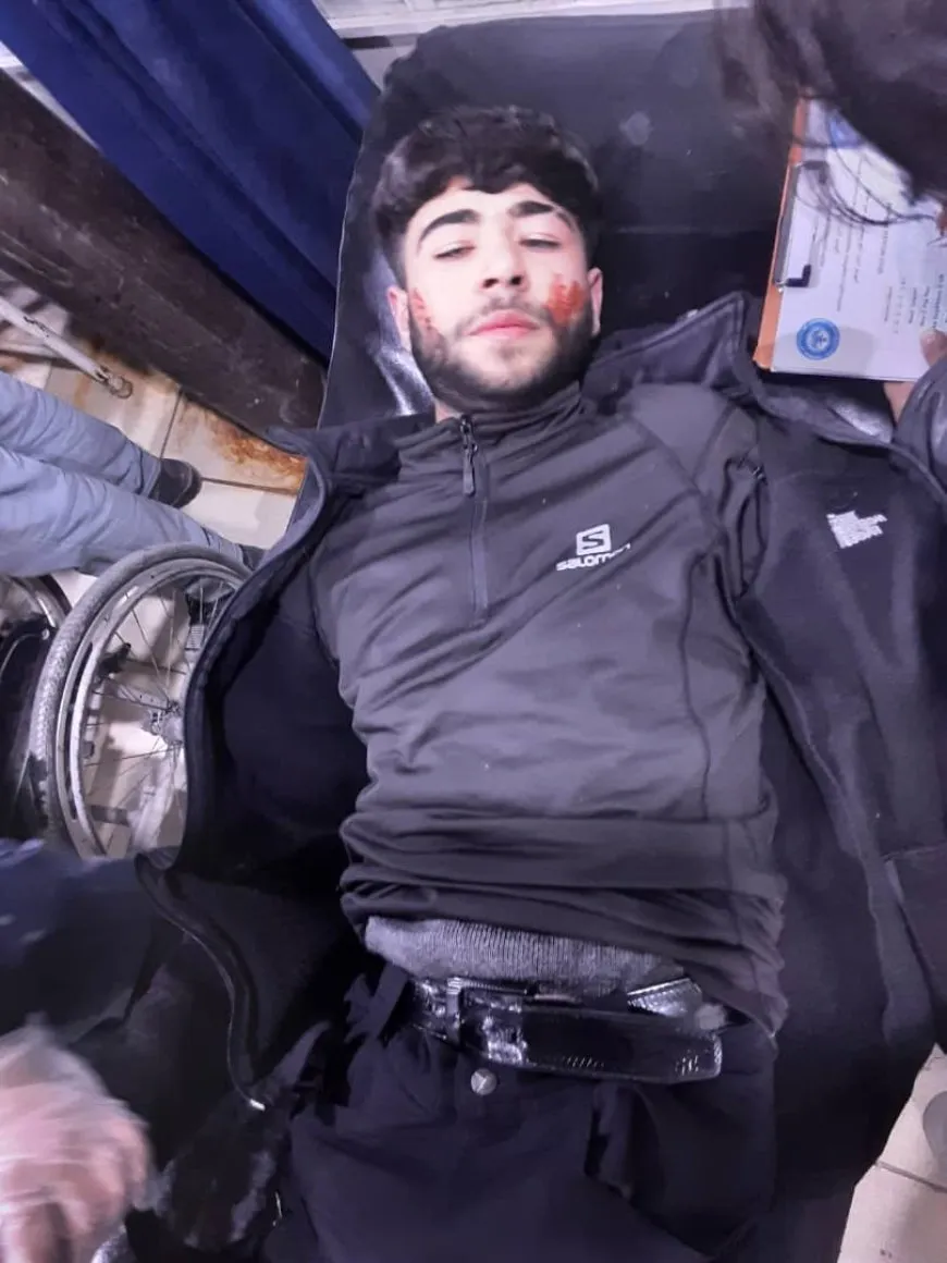 3 martyrs and 17 wounded inlatest toll from the interim government's shelling of Aleppo neighborhoods