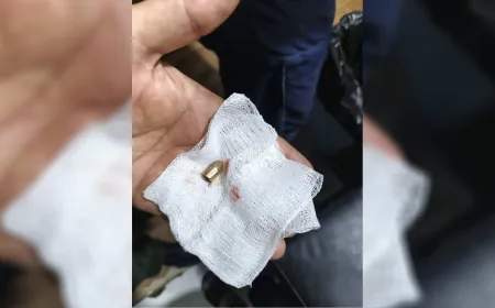 young woman injured by stray bullet in Kobani.