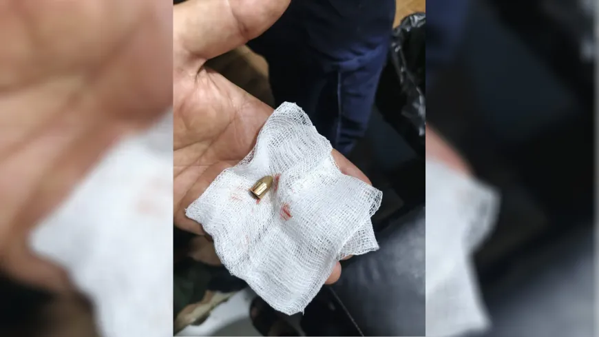 young woman injured by stray bullet in Kobani.