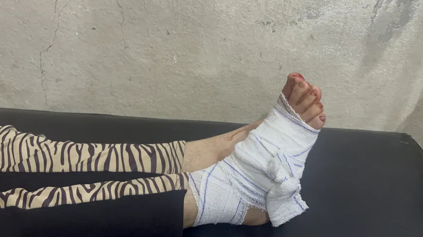 young woman injured by stray bullet in Kobani.