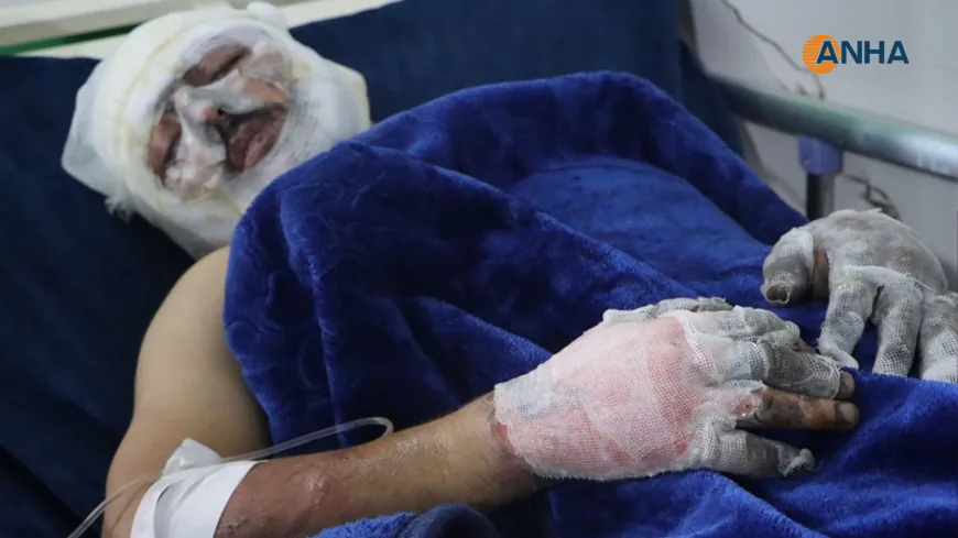 9 inmates die, 17 injured in Kobani prison fire