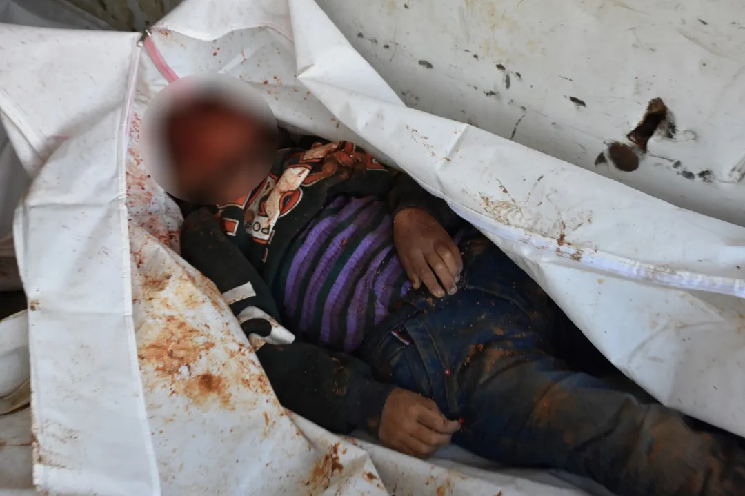 11 civiles martirizados y heridos, incluyendo niños como resultado de la explosión de la mina
