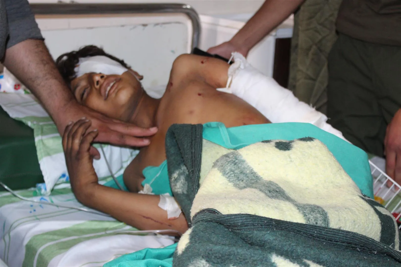 Tres niños muertos y siete heridos por explosión en Jasser Abyed