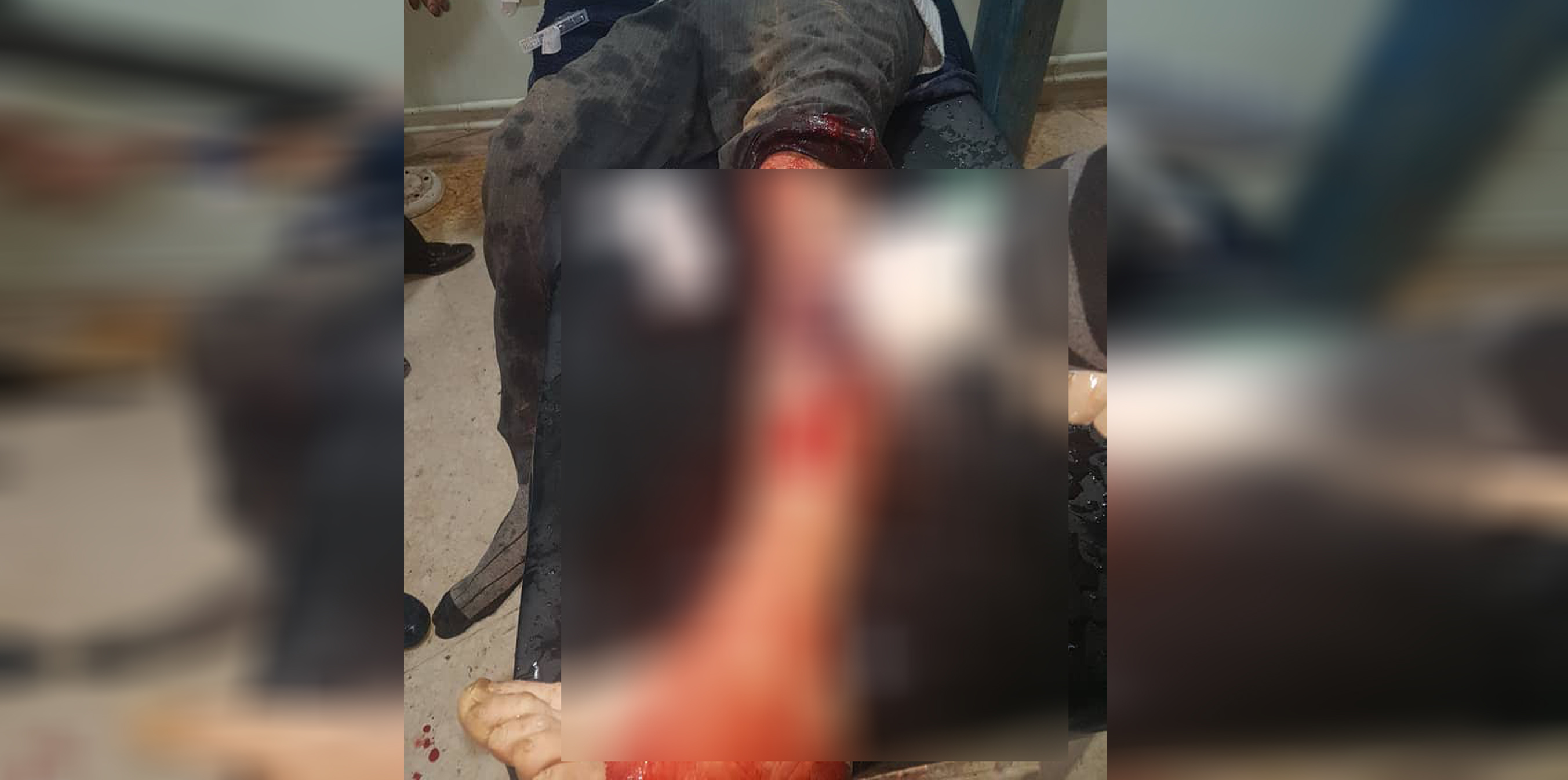 1 ciudadano herido por balas turcas en Amuda
