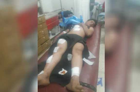 Cuatro civiles heridos se enfrentan al intento de robo de mercenarios turcos