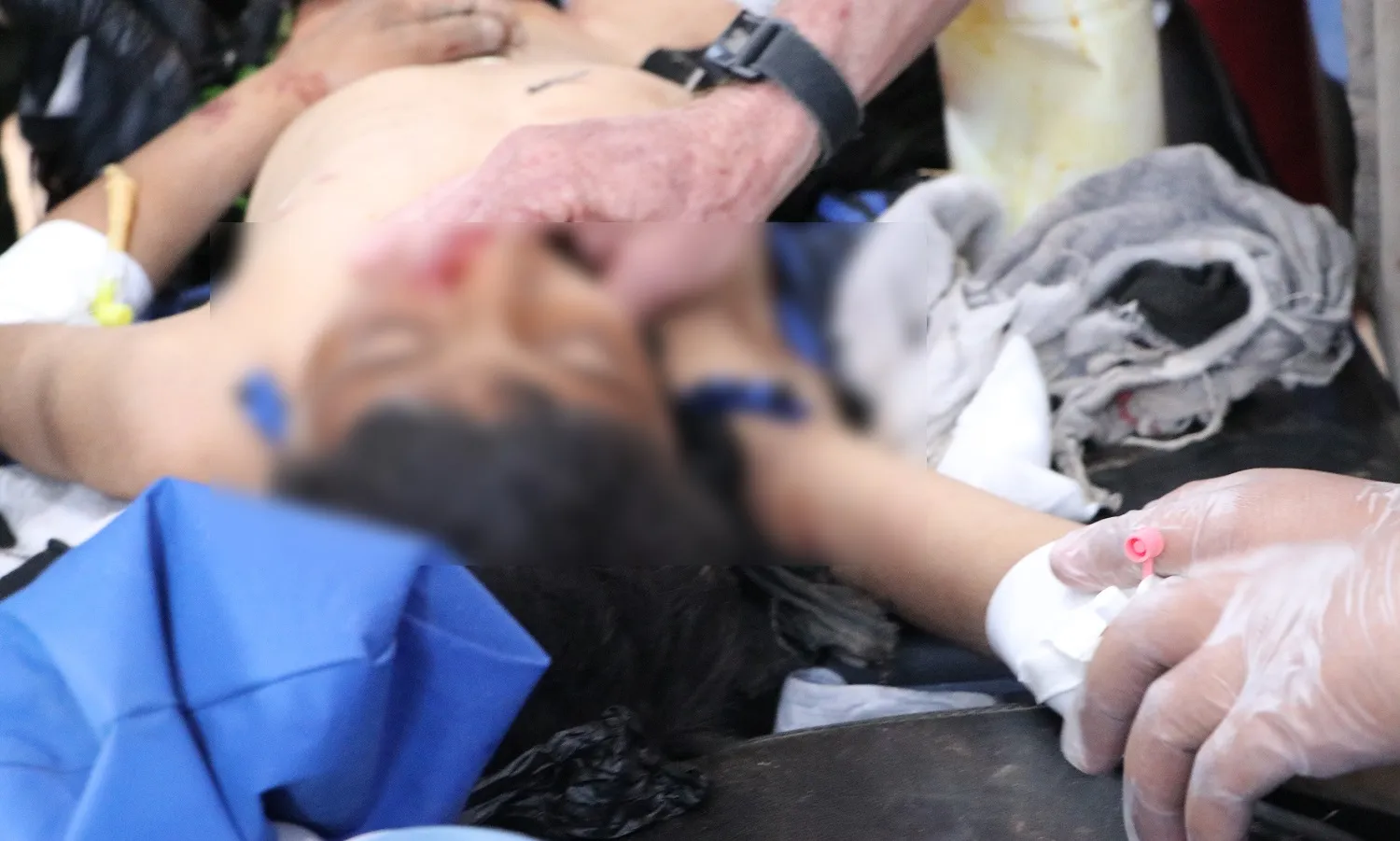 Debido a sus heridas, el niño Hatem Hazem pierde su vida
