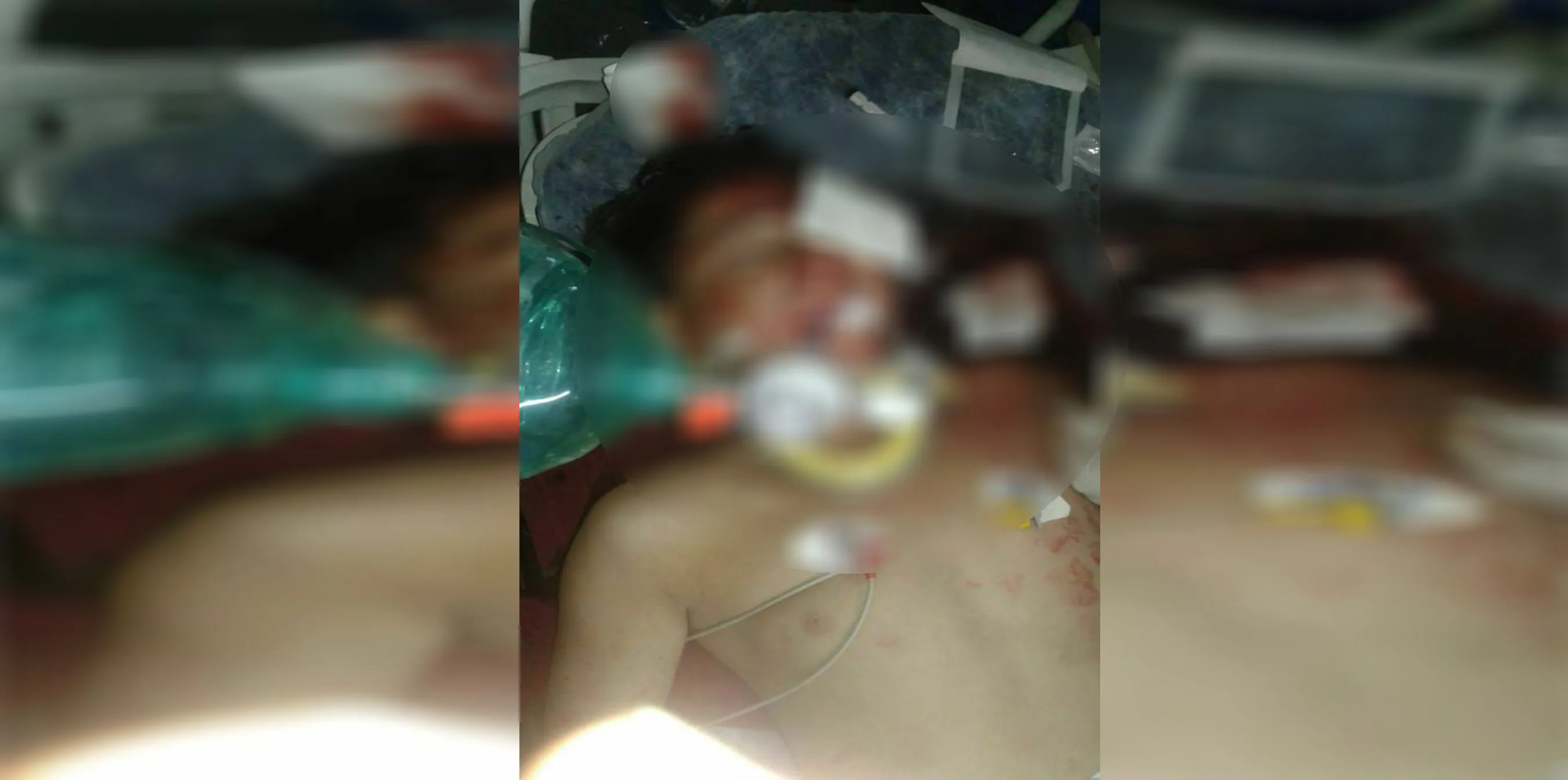 Vehículo blindado turco atropelló a dos niños en Afrin ocupado