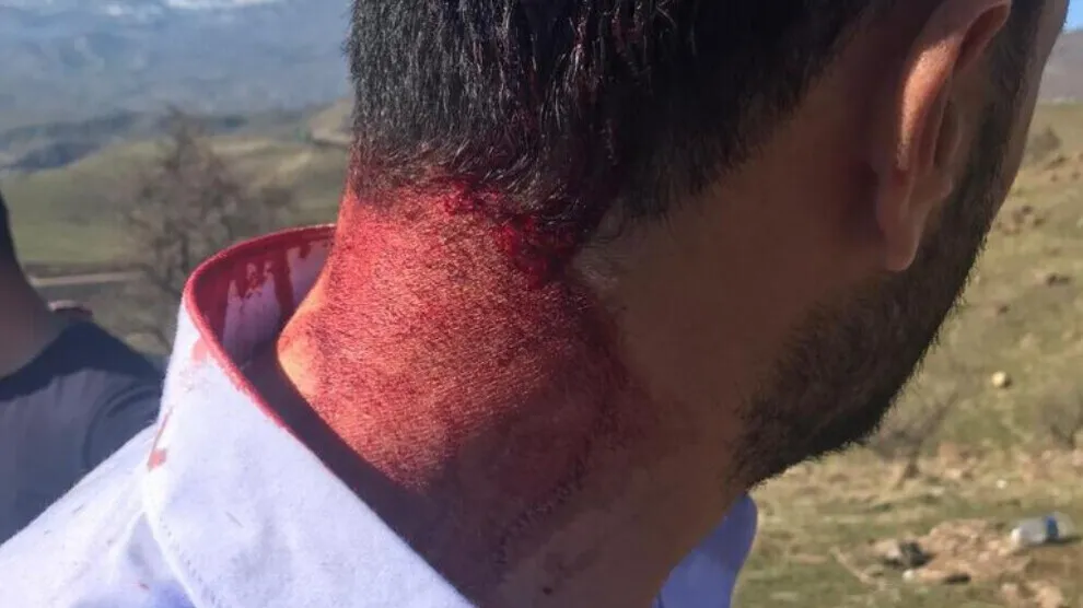 Soldados turcos atacan a un joven kurdo en Colemerg