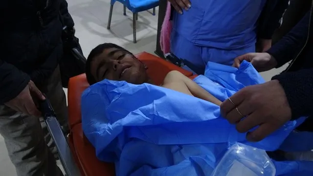 Padre del niño herido: mercenarios bombardearon directamente una aldea poblada
