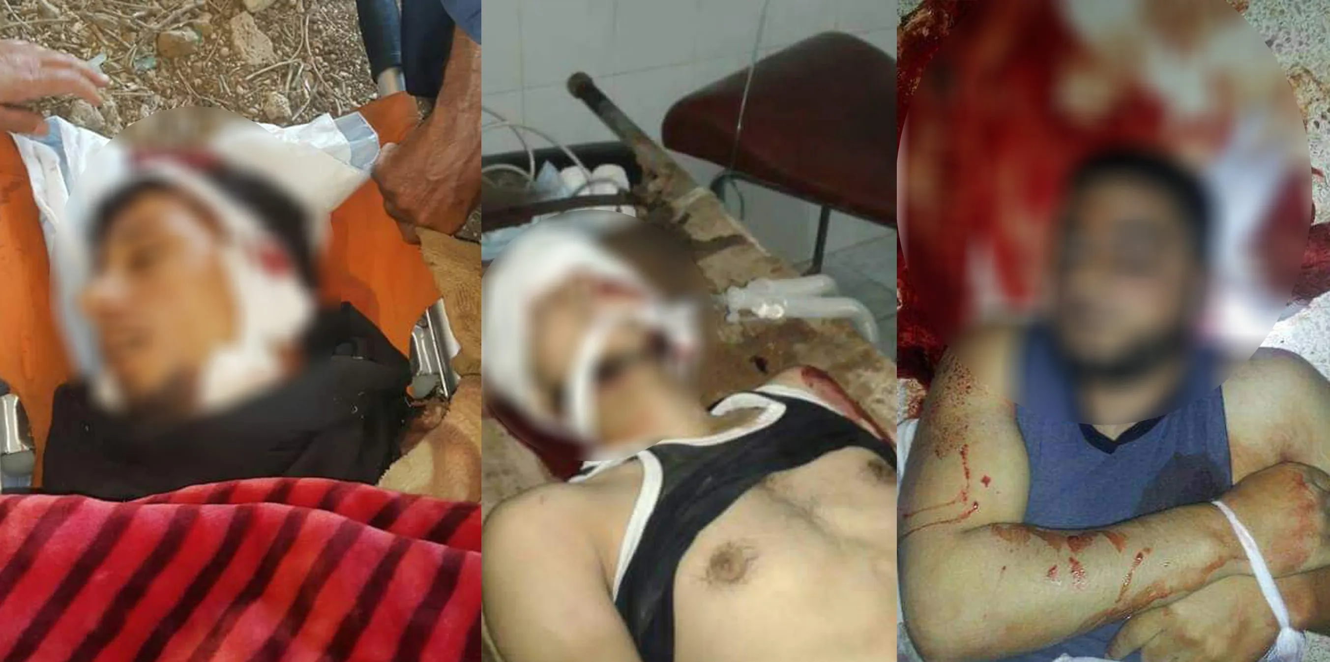 Fuentes: al menos tres mercenarios turcos muertos en un atentado en Afrin