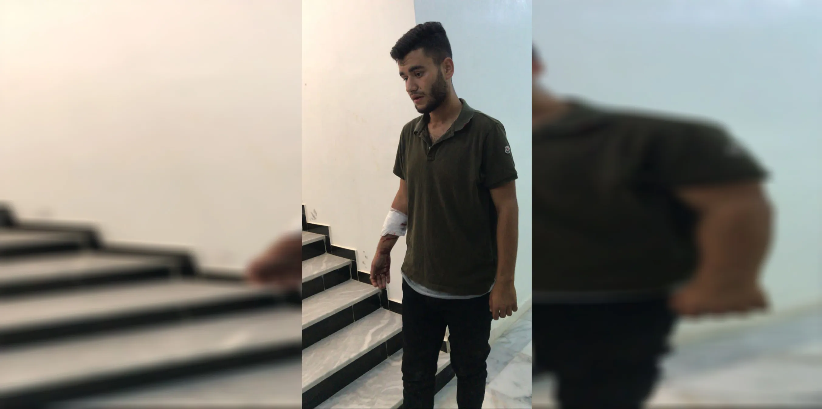 Al menos un mártir y 4 heridos por los bombardeos turcos contra Kobane