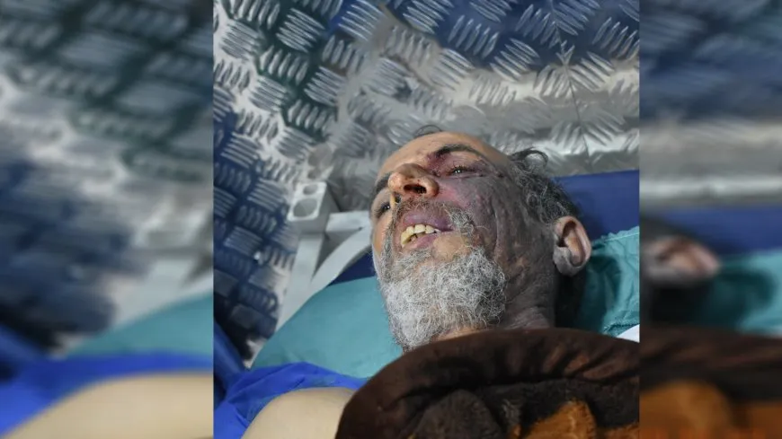 La situación de tres personas heridas por el bombardeo turco es crítica 