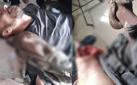 Ataque de los ocupantes turcos en Sharawa: un civil resultó herido