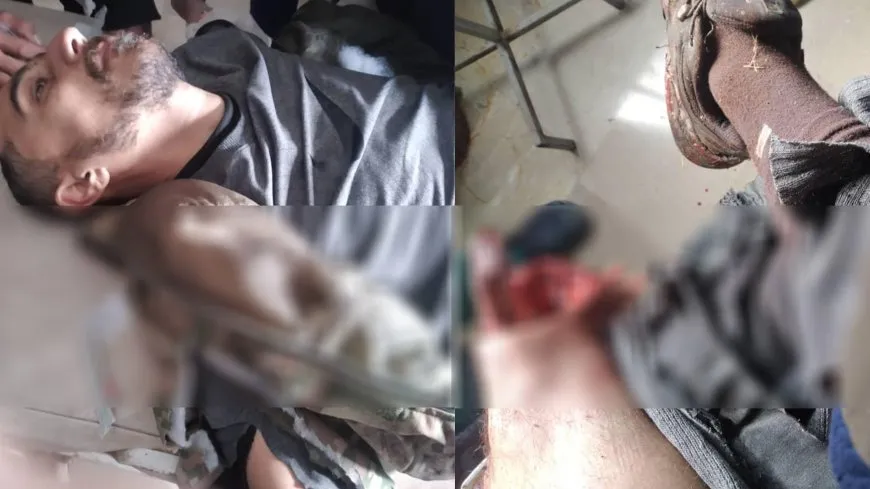 Ataque de los ocupantes turcos en Sharawa: un civil resultó herido