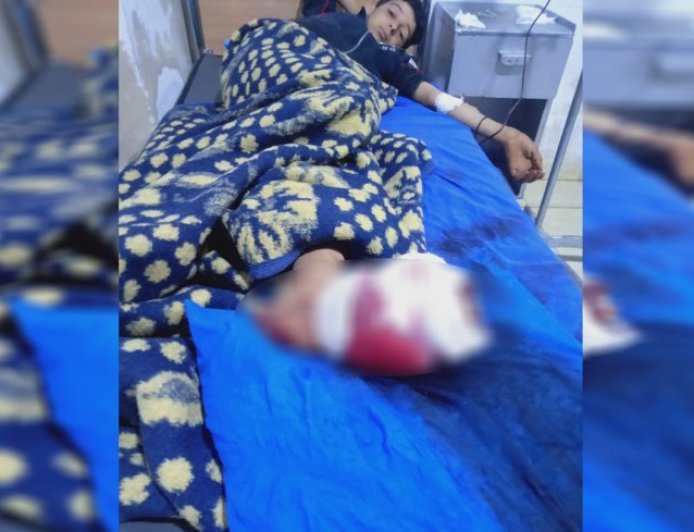 El ejército turco de ocupación ataca Shahba: dos niños heridos