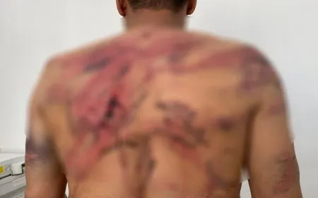 Los ocupantes turcos torturan a 8 jóvenes, entre ellos dos niños 