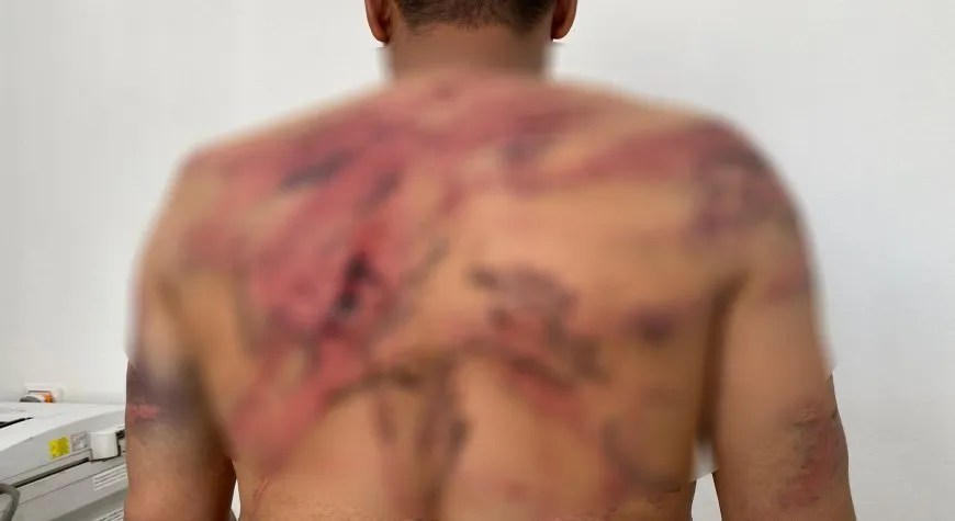Los ocupantes turcos torturan a 8 jóvenes, entre ellos dos niños 