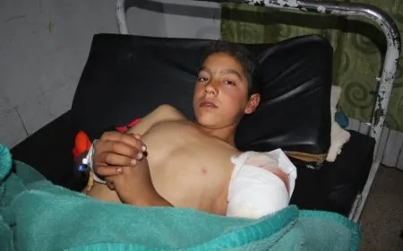 El niño herido en los ataques turcos es dado de alta del hospital