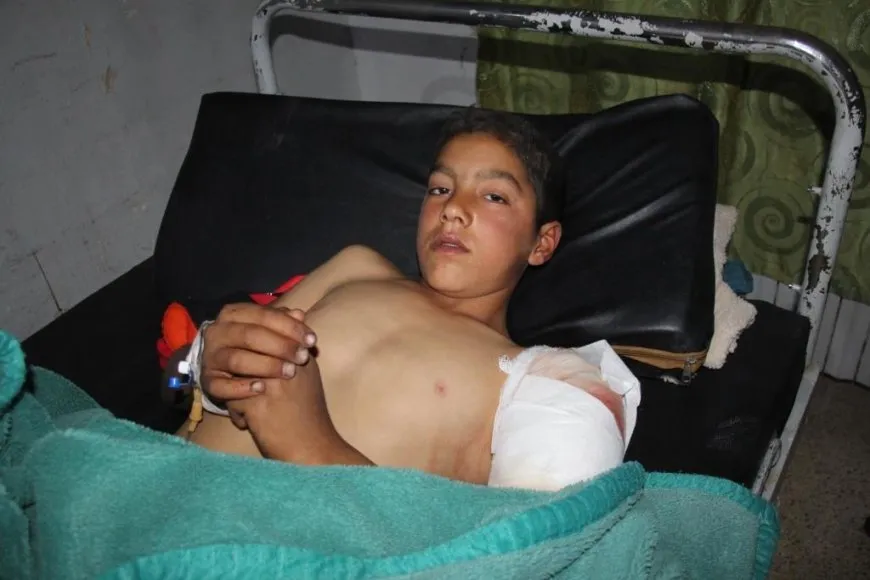 El niño herido en los ataques turcos es dado de alta del hospital