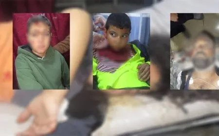 El intenso bombardeo de 12 horas de la ocupación turca deja varias víctimas