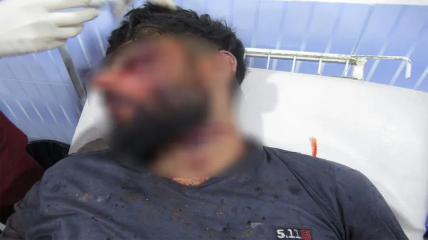 Explosión de una mina en Shahba: 6 personas heridas