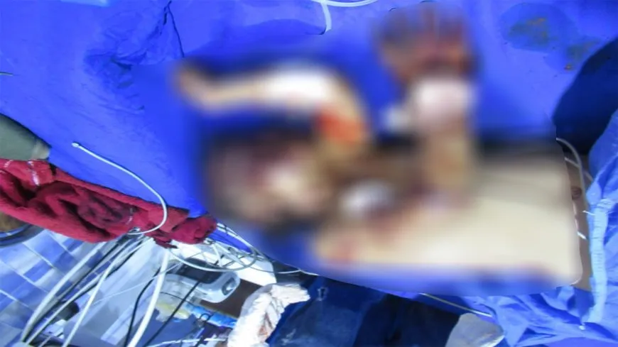 Explosión de una mina en Shahba: 6 personas heridas