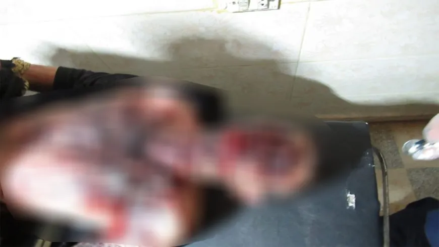 Explosión de una mina en Shahba: 6 personas heridas