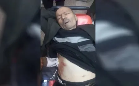 Otro civil herido en el bombardeo por parte de mercenarios interinos del gobierno en Sheikh Maqsoud