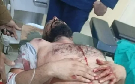Intento de asesinato contra comandante de la 62ª División deja herido grave en Hama