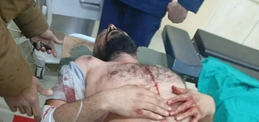 Intento de asesinato contra comandante de la 62ª División deja herido grave en Hama
