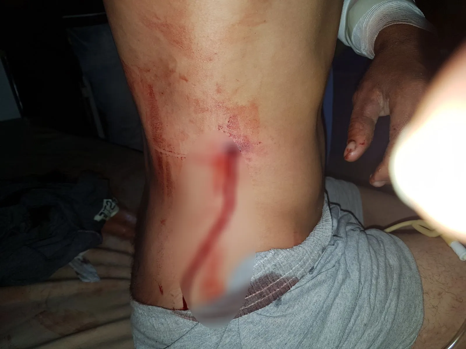 Artêşa Tirk cotkarekî  Serêkaniyê birîndar kir
