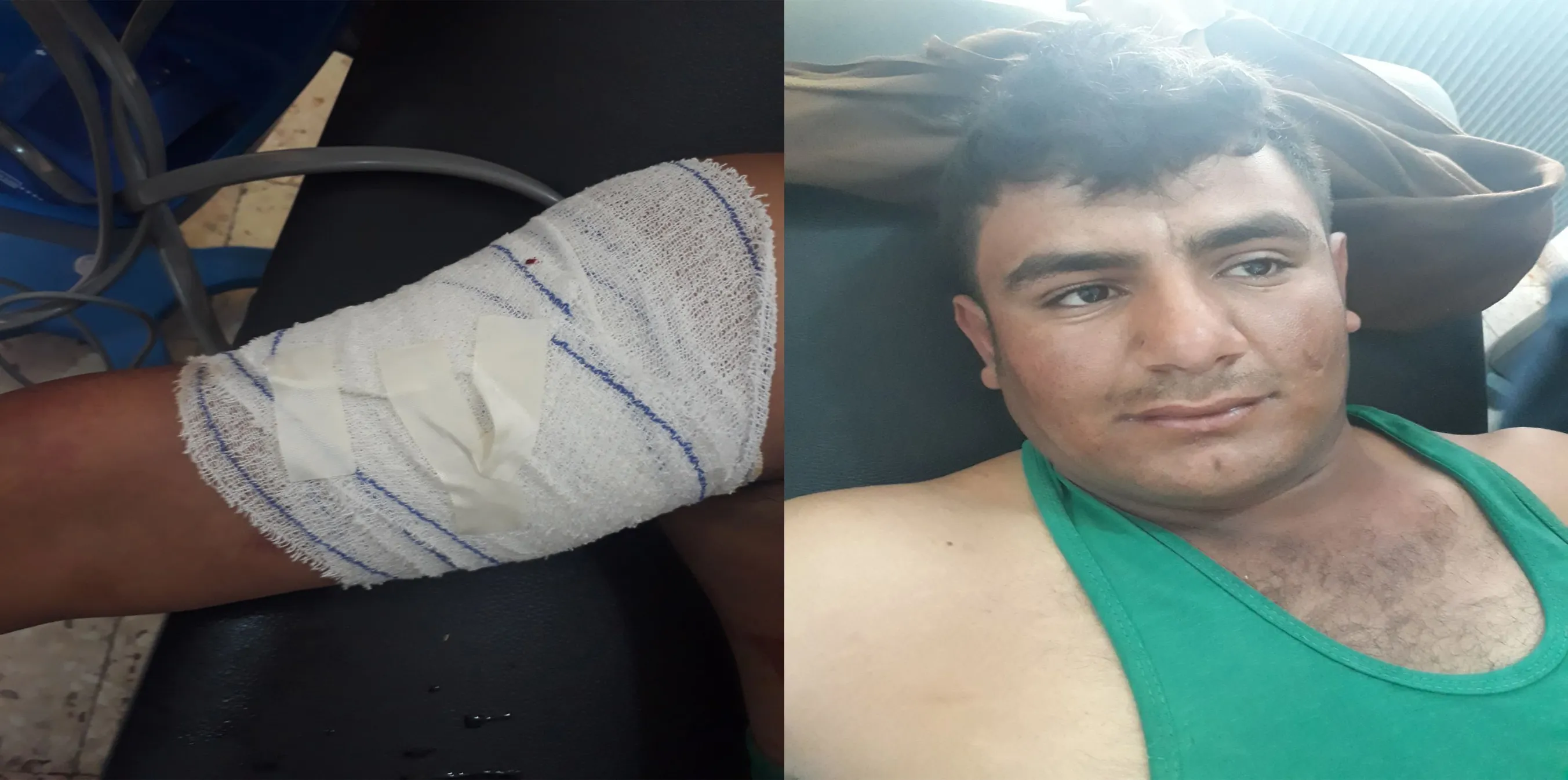 Artêşa dagirker welatiyek birîndar kir
