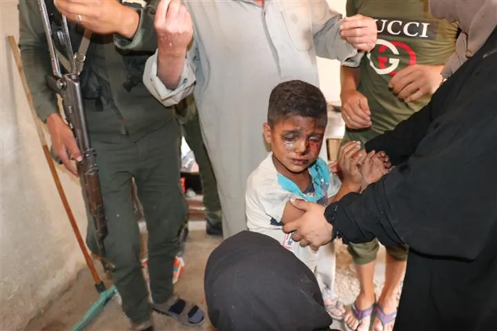 Li navçeya Şedadê bombeyek teqiya: Zarokek birîndar bû