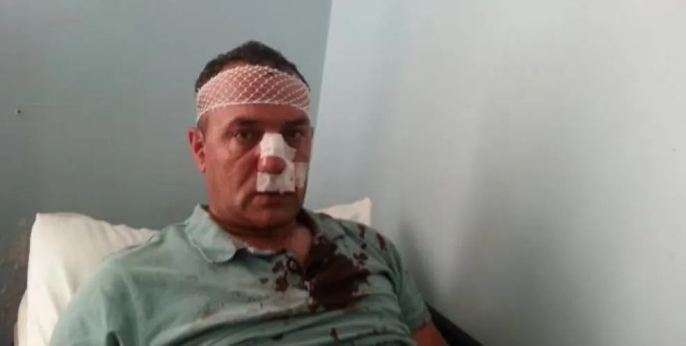AKP'yiyan li rayedarên HDP'ê xistin