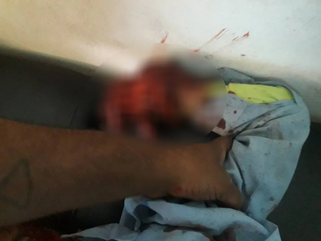 Zarokê 11 salî destê xwe winda kir