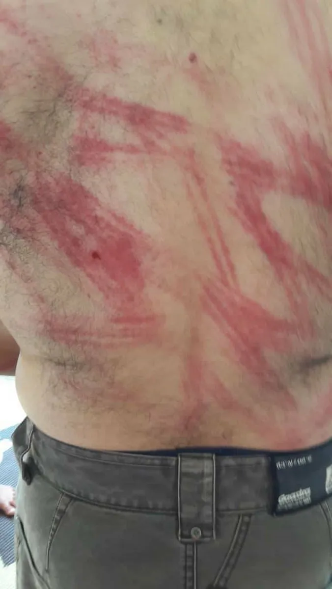 Hêzên dagirker revandin û êşkencekirina sivîlan didomînin