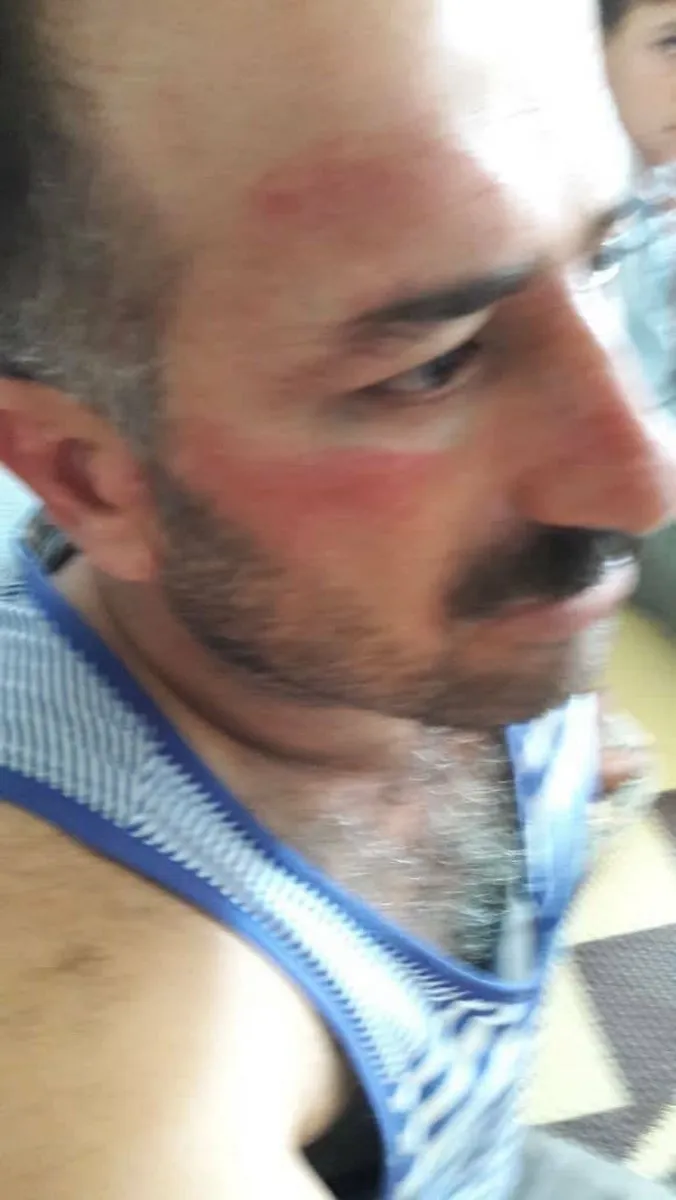 Hêzên dagirker revandin û êşkencekirina sivîlan didomînin