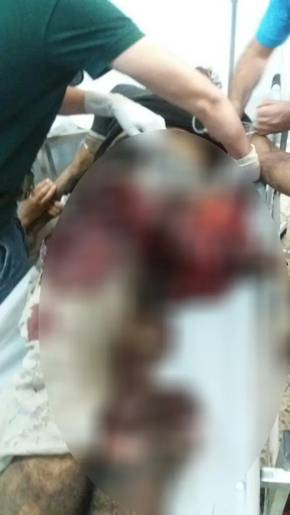 Li herêma Hesekê mayîn bi erebeyekê de teqiya, birîndar hene –HATE NÛKIRIN