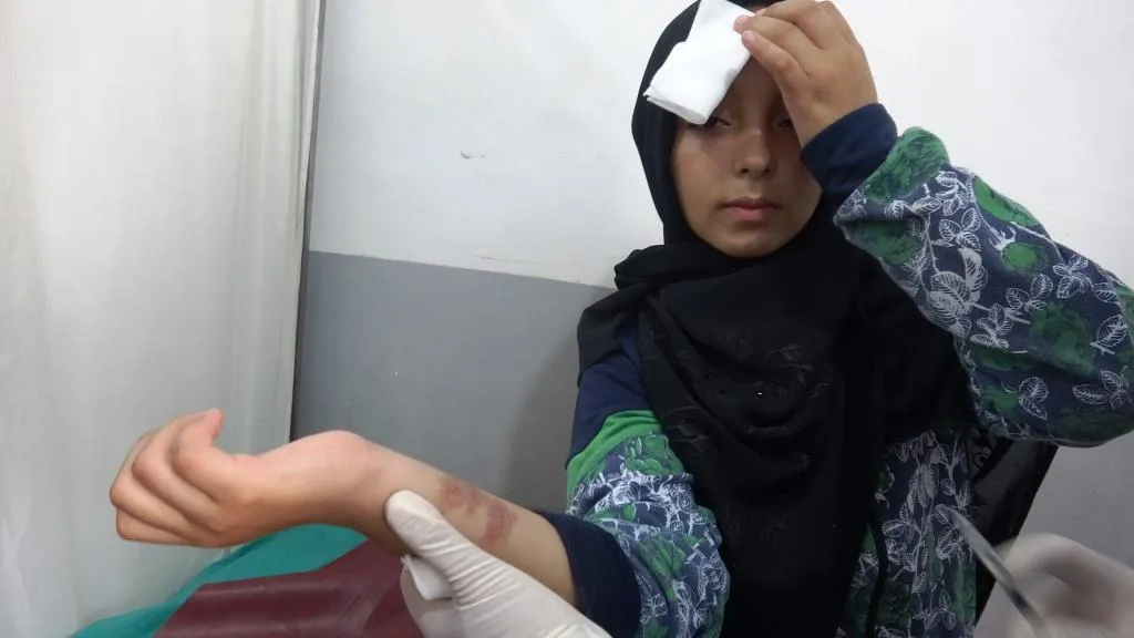400 nexweşên laşmanyayê têne dermankirin