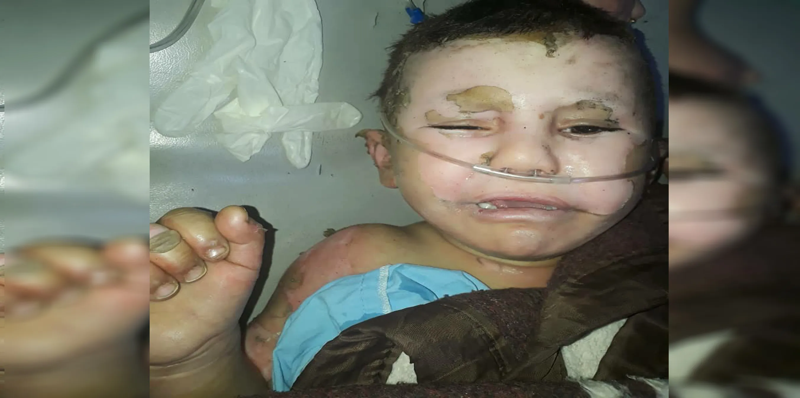 Ji ber teqîna cereya gazê 4 kes birîndar bûn