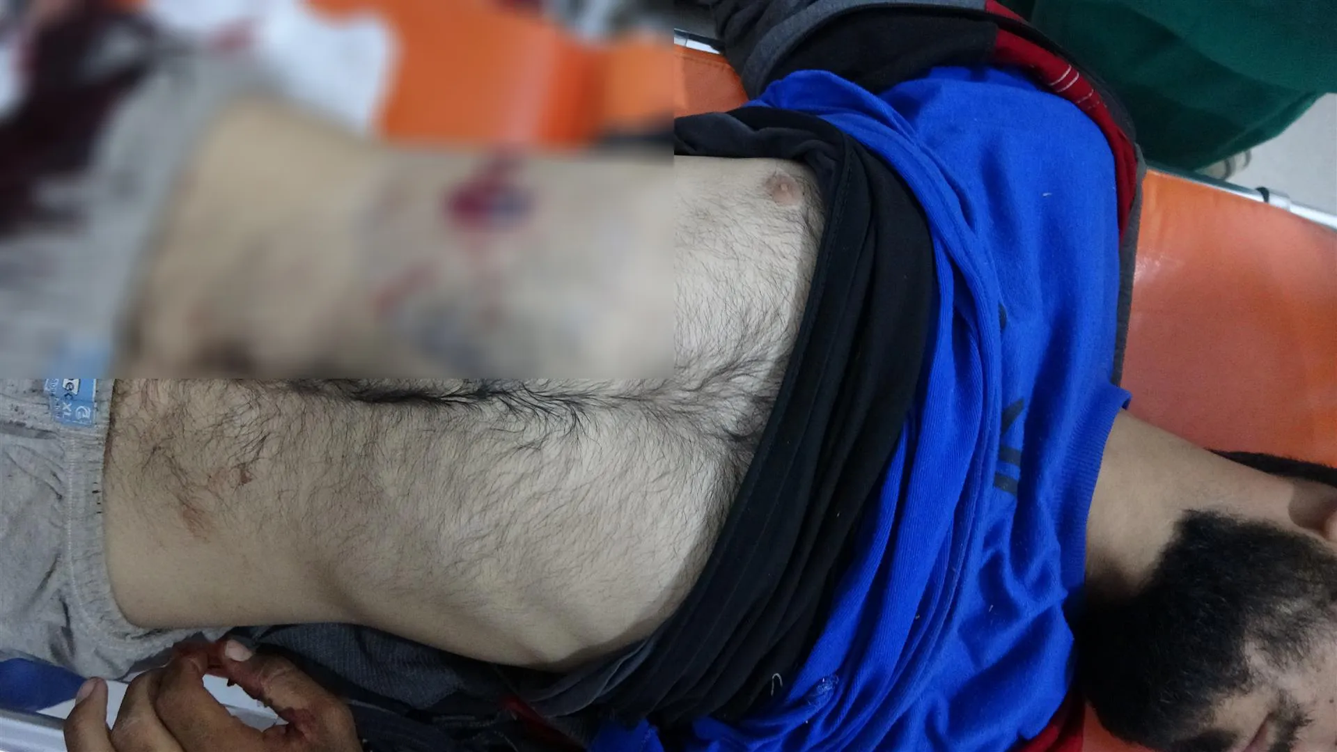 Li gundê navçeya Tirbespiyê endamekî Senadîd birîndar bû