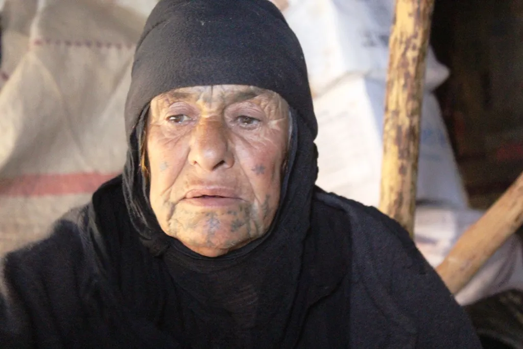 Piştî barîna baranê azarên koçberên kampa Tiwêhîna zêde bûn