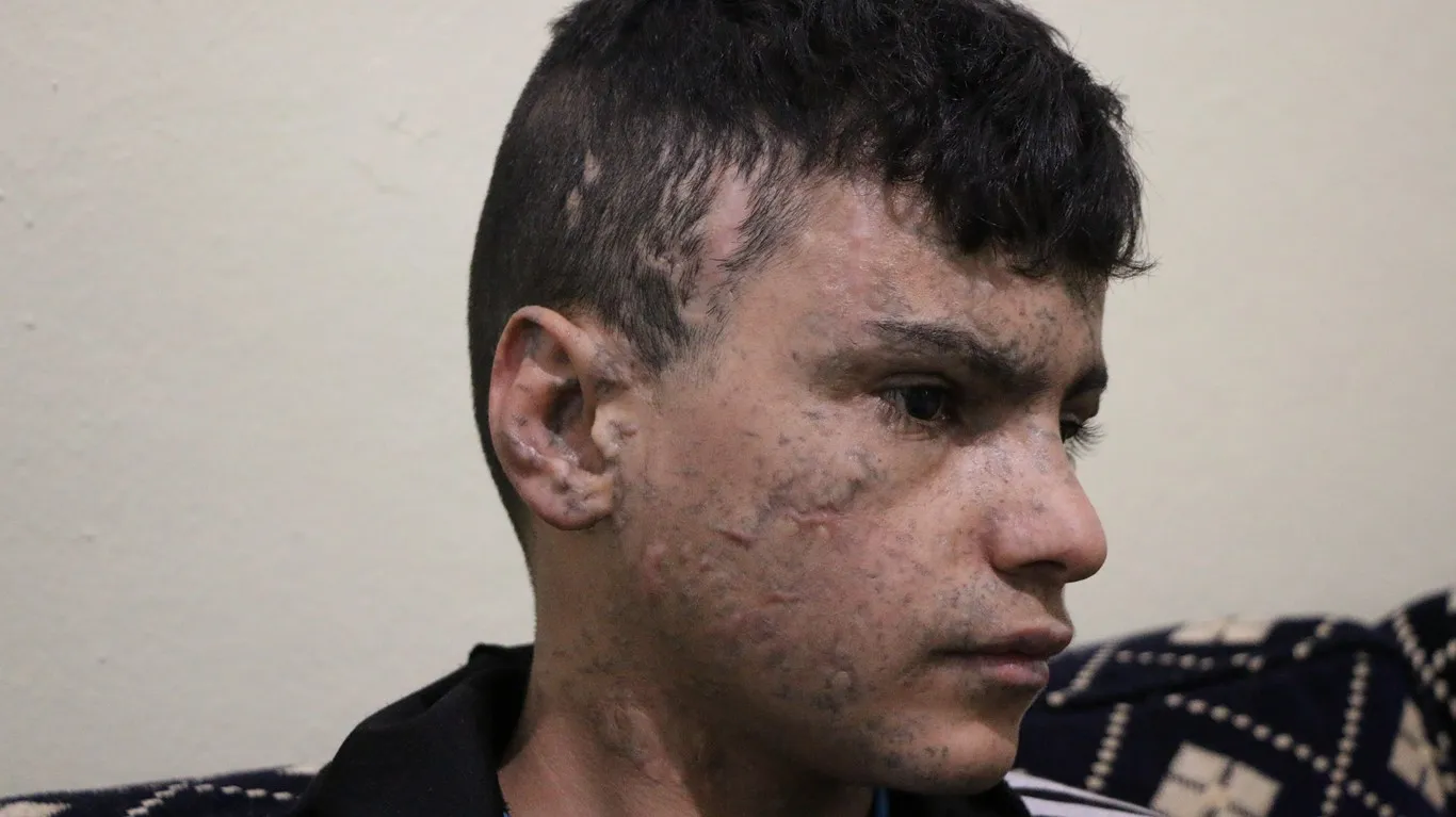 Kongreya Star wê her du zarokên Tirkiyê birîndar kirî, derman bike
