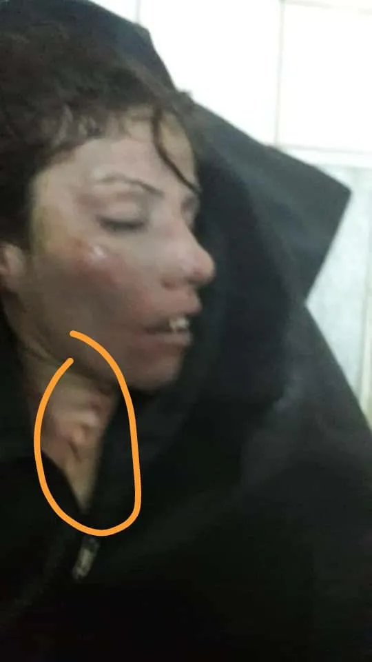 Dagikeriya Tirk jineke Efrînê kuştin û hinek sivîl jî birîndar kirin