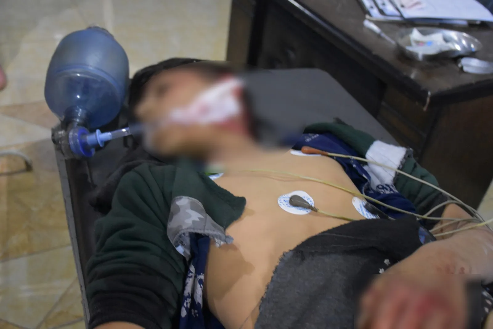 Li Şehbayê ji ber teqîna mayînekê zarokek mir û 3 jî birîndar bûn