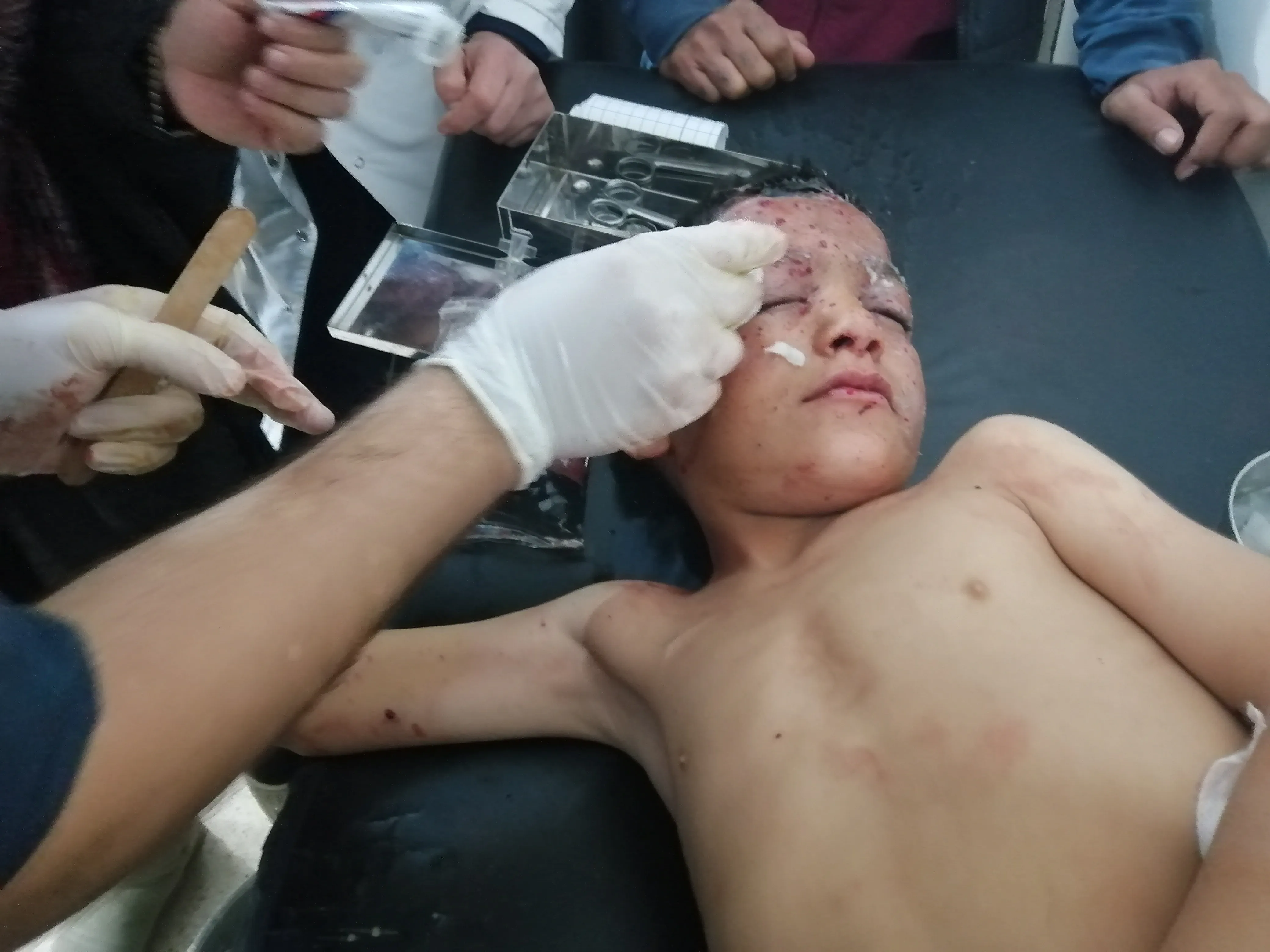Mayinek li Tebqayê teqiya, zarokek birîndar bû