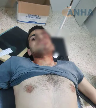 Hejmara şehîdên teqîna Reqayê derketin 9