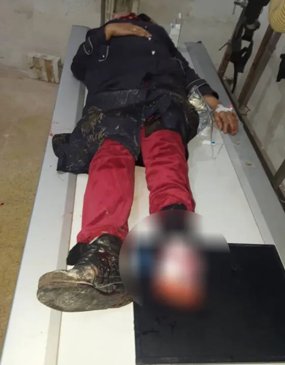Li Tebqayê du mayîn teqiyan: Welatiyek mir, 4 jî birîndar bûn- Hate Nûkirin