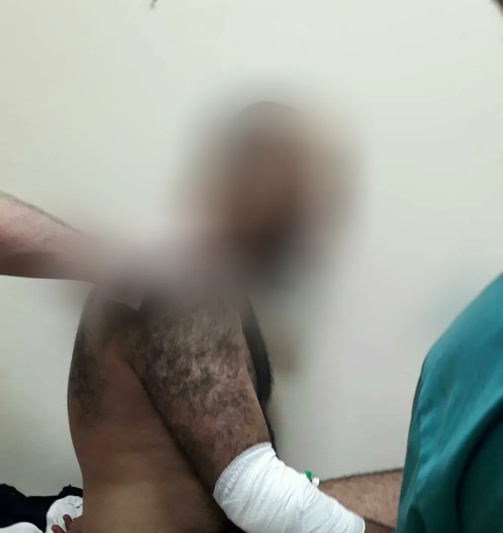 Li Ezazê şer rû dide: Herê kêm 7 kes hatin kuştin