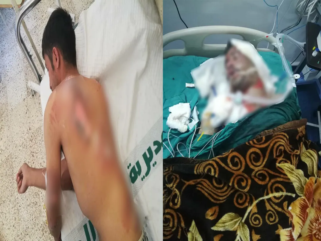 Meclisa Rêveber ji bo şehîdên şewata li Til Koçerê sersaxî xwest